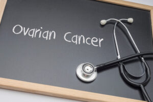 Testing for Ovarian Cancer with the HrC test