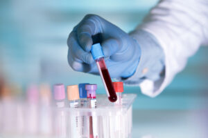 The HrC test - The most advanced blood test for cancer