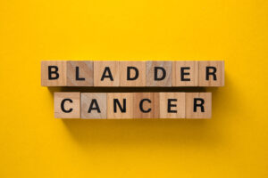 Testing for Bladder Cancer with The HrC Test